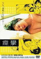 痙攣　けいれん