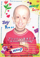 アシュリーと生きて…　～短い命を刻む少女・７年間の記録～