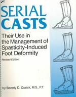 Serial Casts : Their Use in the Management of Spasticity Induced Foot Deformity （Revised Spiral）