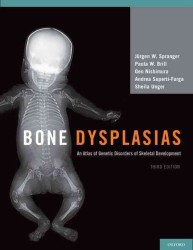 先天性骨系統疾患アトラス（第３版）<br>Bone Dysplasias : An Atlas of Genetic Disorders of Skeletal Development （3TH）