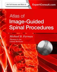 Atlas of Image-Guided Spinal Procedures : Expert Consult （HAR/PSC）
