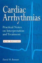 Cardiac Arrythmias : Practical Notes on Interpretation and Treatment （6 SUB）