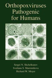 Around Burnside (Ergebnisse Der Mathematik Und Ihrer Grenzgebiete 3 Folge)