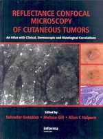 Reflectance Confocal Microscopy of Cutaneous Tumors : An Atlas with Clinical, Dermoscopic and Histological Correlations （1ST）