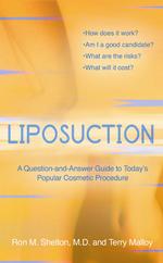 Liposuction : A Question-And-Answer Guide to Today's Popular Cosmetic Procedure