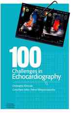 100 Challenges in Echocardiography （1ST）