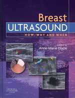Breast Ultrasound : How, Why and When (How, Why and When)