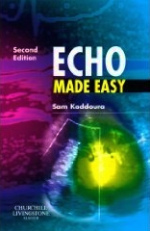 Echo Made Easy (Made Easy) -- Paperback