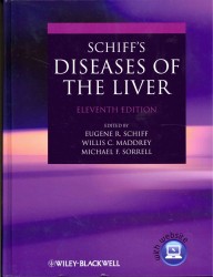 シフ肝臓病学（第１１版）<br>Schiff's Diseases of the Liver （11TH）