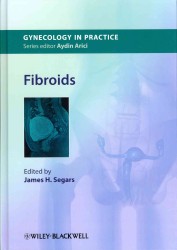 Fibroids (Gynecology in Practice)