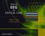 集中治療におけるEEGアトラス<br>Atlas of EEG in Critical Care （ILL）