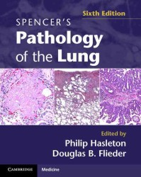 スペンサー肺の病理学（第６版）<br>Spencer's Pathology of the Lung 2 Part Set with DVDs （6TH）