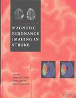 卒中におけるＭＲＩ<br>Magnetic Resonance Imaging in Stroke