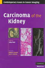 Carcinoma of the Kidney (Contemporary Issues in Cancer Imaging)