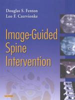 Image-Guided Spine Intervention