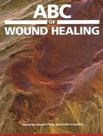 ABC of Wound Healing (Abc)