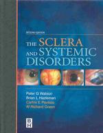 The Sclera and Systemic Disorders （2ND）