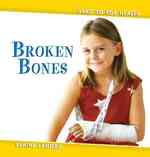 Broken Bones (Head to Toe Health)