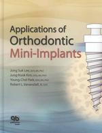 Applications of Orthodontic Mini Implants