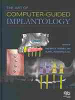 The Art of Computer-guided Implantology