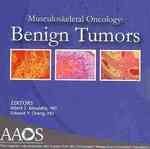 Musculoskeletal Oncology : Benign Tumors （1 DVDR）