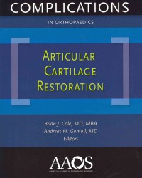 Articular Cartilage Restoration (Complications in Orthopaedics) （1ST）