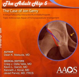 The Adult Hip 5 : The Case of John Gerry （1 CDR）