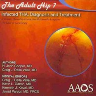 Adult Hip 7 Infected THA : Diagnosis and Treatment: a Virtual Fellowship Interactive Muyltimedia Program, the Case of Cara DeVry （1 DVD）