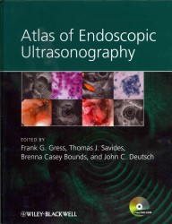 超音波内視鏡検査アトラス<br>Atlas of Endoscopic Ultrasonography （1 HAR/DVDR）