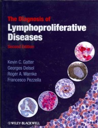 リンパ球増殖性疾患の診断（第２版）<br>The Diagnosis of Lymphoproliferative Diseases （2ND）