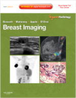 乳房：エキスパート画像診断シリーズ<br>Breast Imaging (Expert Radiology Series) （1 HAR/PSC）
