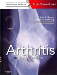 関節炎画像診断入門（第３版）<br>Arthritis in Black and White : Expert Consult - Online and Print （3RD）