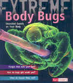 Body Bugs! : Uninvited Guests on Your Body (Fact Finders: Extreme!)