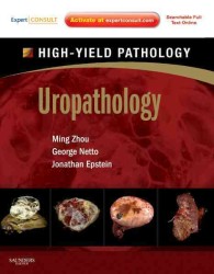 泌尿器病理学：ハイ・イールド病理学シリーズ<br>Uropathology (High-yield Pathology) （1 HAR/PSC）
