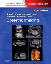 産科画像診断：エキスパート画像診断シリーズ<br>Obstetric Imaging : Expert Consult Premium Edition (Expert Radiology) （1 HAR/PSC）