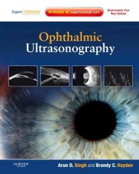 眼科における超音波検査<br>Ophthalmic Ultrasonography : Expert Consult - Online and Print