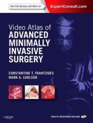 先端的低侵襲外科ビデオアトラス<br>Video Atlas of Advanced Minimally Invasive Surgery （1 HAR/PSC/）