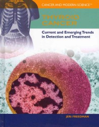 Thyroid Cancer (Cancer and Modern Science) （Library Binding）