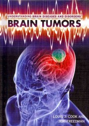 Brain Tumors (Understanding Brain Diseases and Disorders) （Library Binding）