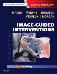 画像ガイド下インターベンション：エキスパート画像診断シリーズ（第２版）<br>Image-Guided Interventions (Expert Radiology) （2 HAR/PSC）