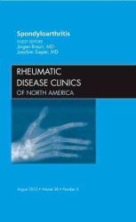 Spondyloarthropathies, an Issue of Rheumatic Disease Clinics (The Clinics: Internal Medicine)