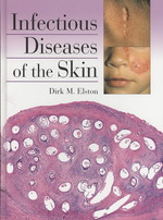 Infectious Diseases of the Skin （1ST）