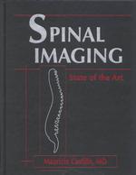 Spinal Imaging : State of the Art