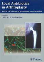 Local Antibiotics in Arthroplasty : State of the Art from an Interdisciplinary Point of View （1ST）