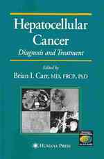 Hepatocellular Cancer : Diagnosis and Treatment (Current Clinical Oncology) （1ST）