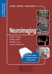 Q&A Color Review of Neuroimaging (Q&a Color Review) （1ST）