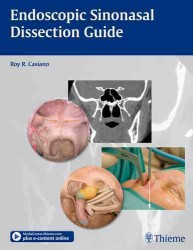 内視鏡下副鼻腔解剖ガイド<br>Endoscopic Sinonasal Dissection Guide （1 SPI HAR/）