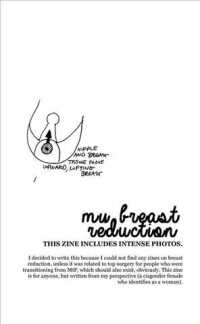 Why I Got My Breast Reduction （SEW PMPLT）