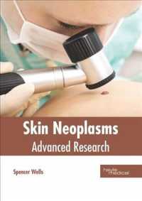 Skin Neoplasms : Advanced Research