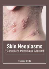 Skin Neoplasms : A Clinical and Pathological Approach
